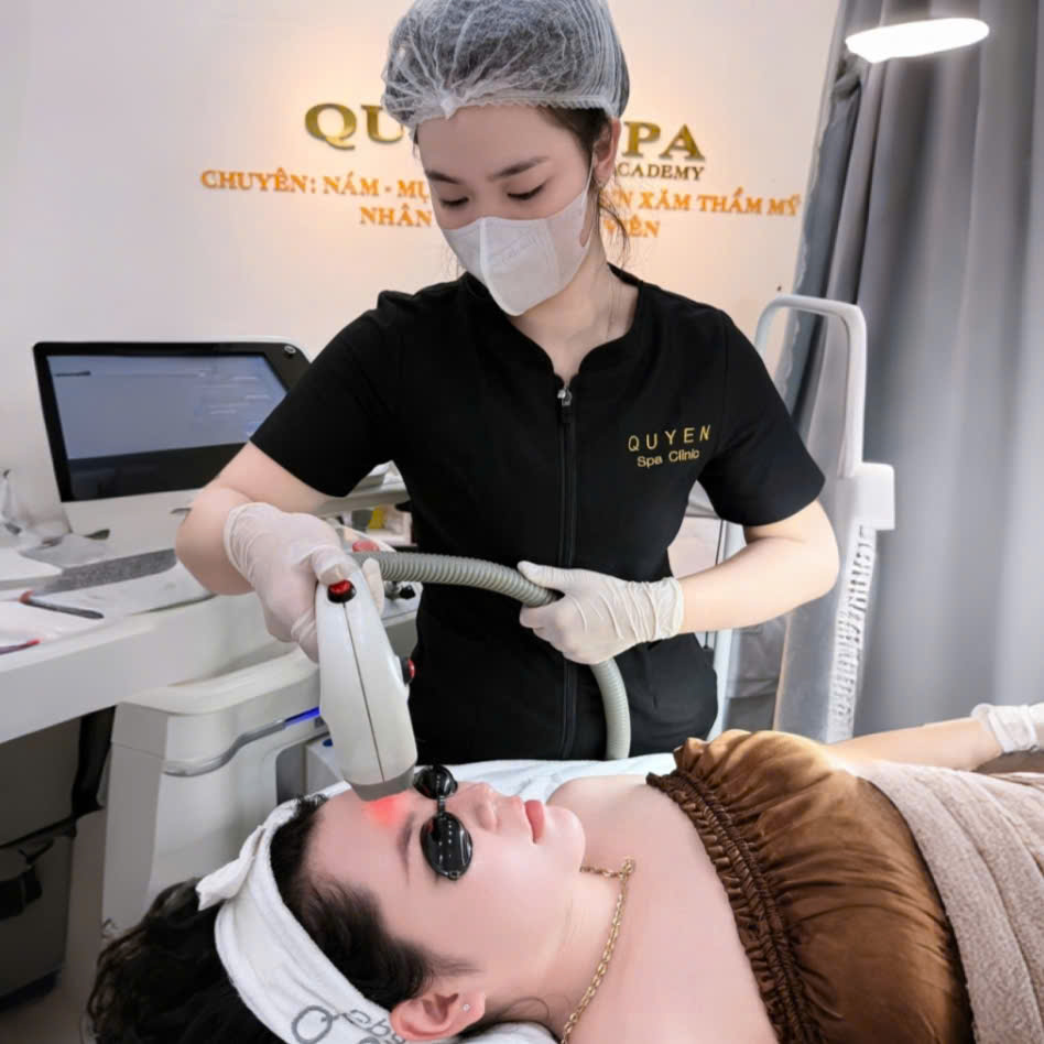 Điều trị mụn bằng công nghệ laser tại Quyên Spa